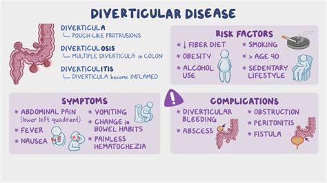 Diverticulitis Vs Diverticulosis