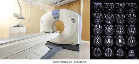 Image result for CT Scanner Machine