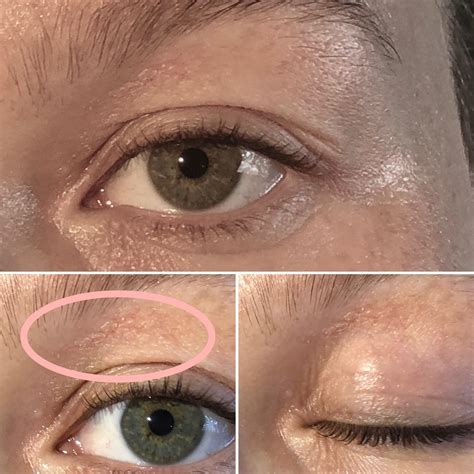 Dry Eye Lids. Any suggestions for sensitive hydrating eye creams? : r/30PlusSkinCare