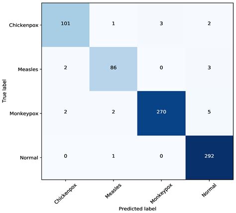 TMS: Ensemble Deep Learning Model for Accurate Classification of ...