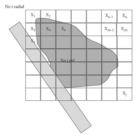 Image result for Iterative Reconstruction Osem