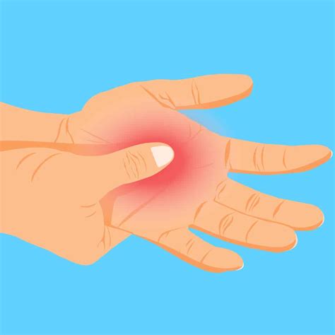 Causes Of Pain In Left Hand Arm at Connie Goodin blog