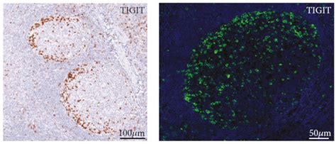 Recent Advances in Understanding the Role of TIGIT+ Follicular Helper T ...