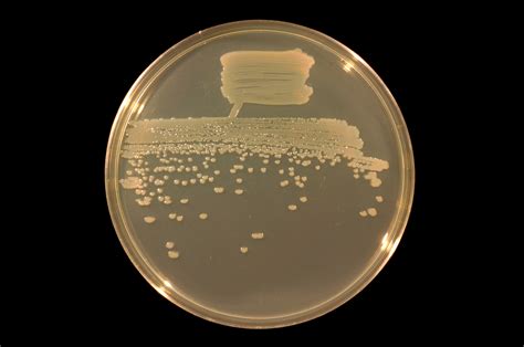 Pseudomonas fluorescens