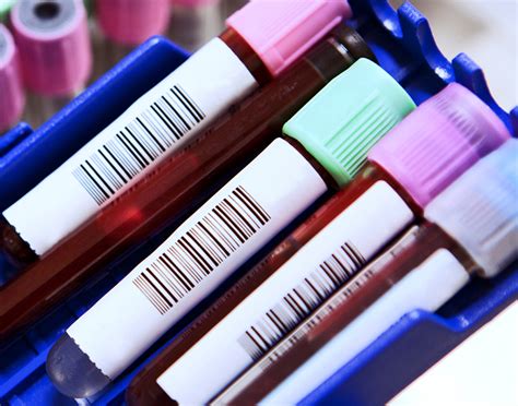 Follicle-stimulating hormone (FSH) blood test