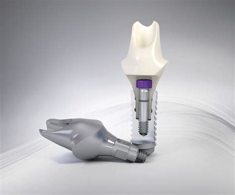 LOCATOR Straumann Bone Level Overdenture Abutment | Zest Dental Solutions