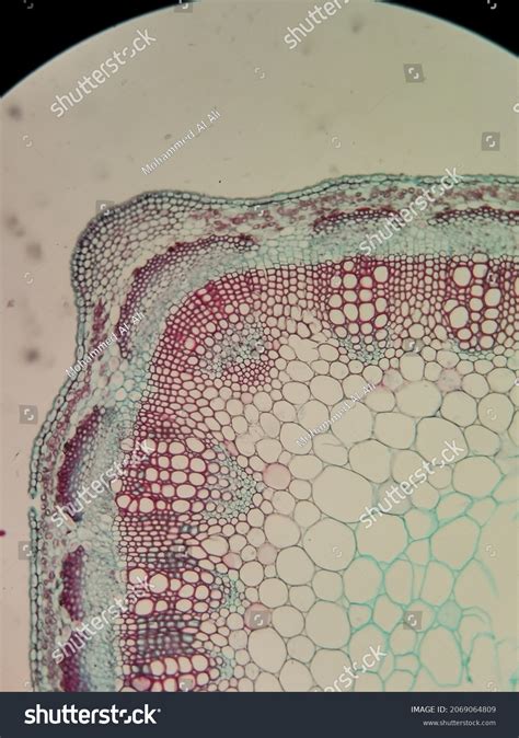 Sclerenchyma Tissue Labeled