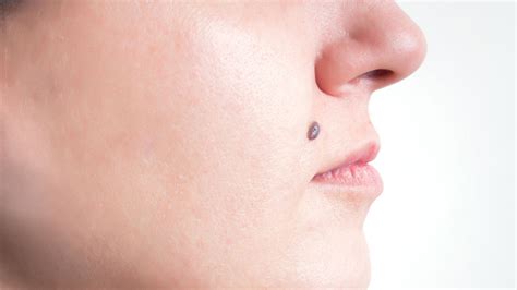 Moles On Body:शरीर पर मौजूद कौन से तिल माने जाते हैं बेहद शुभ, जानें ...