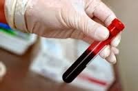 Health Care in Loni, Pathology Labs in Loni, Dental Clinics Loni