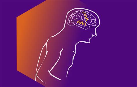 Phase-Amplitude Coupling in Parkinson’s Disease | CogSci Journal