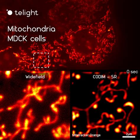 Telight solutions for Cell death research