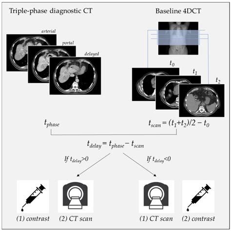 Synchronized Contrast-Enhanced 4DCT Simulation for Target Volume ...