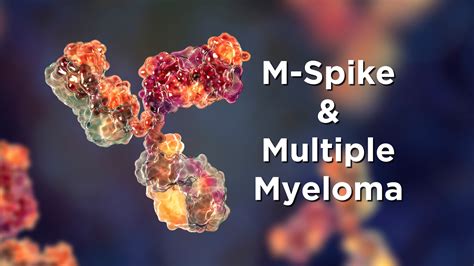M-spike and Multiple Myeloma