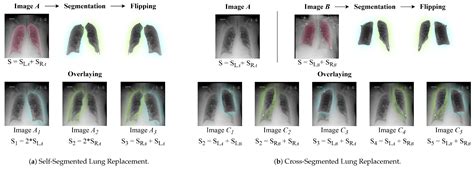 Parallel VMamba and Attention-Based Pneumonia Severity Prediction from ...