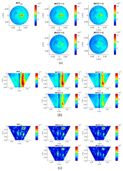 Diagnostics | Special Issue : Electromagnetic Imaging for a Novel ...
