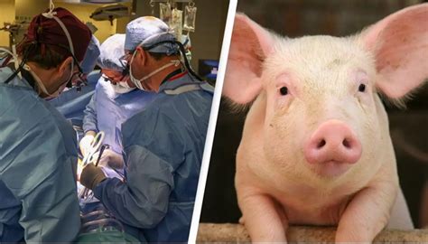 Pig Kidney Transplant Shakes the Medical World: Is This the Future of ...