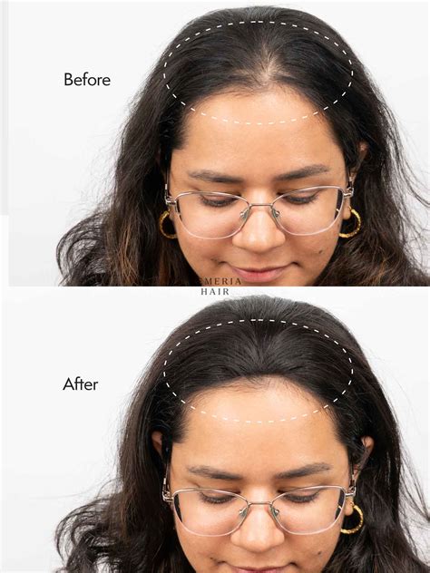 Invisible Hair Patches & Cover-Ups | Gemeria Hair - Gemeria Hair
