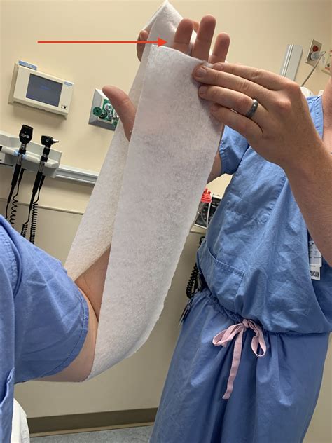 How to Splint a Wrist Fracture - Ortho Conditioning