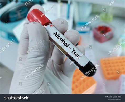 4,022 Alcohol Test Blood Images, Stock Photos & Vectors | Shutterstock