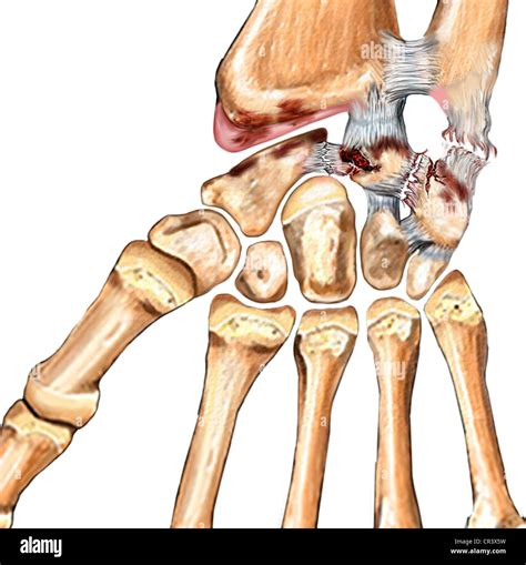 Collateral Ligament Stock Photos & Collateral Ligament Stock Images - Alamy