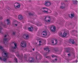 Image result for keratinocytes