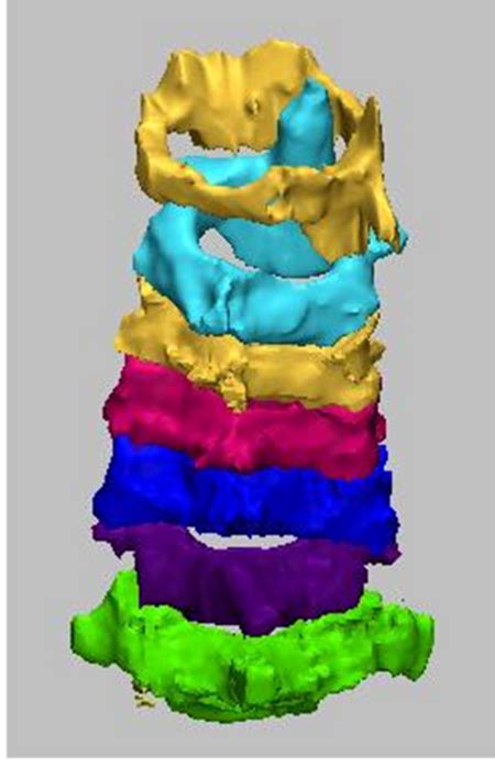 Image result for Motor Control Cervical Rotation