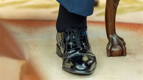 What is chronic venous insufficiency? Everything to know about Trump's ...