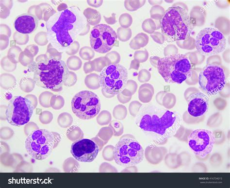 White Blood Cells Under Microscope Labeled