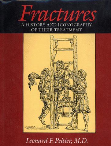 Buy Fractures: a History and Iconography of Their Online at desertcartINDIA