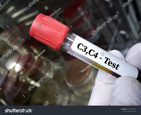 Image result for C4 Complement Blood Test