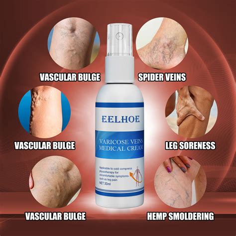 Vein Spray Relief Leg Pain Spider Veins Vasculitis | Ubuy India
