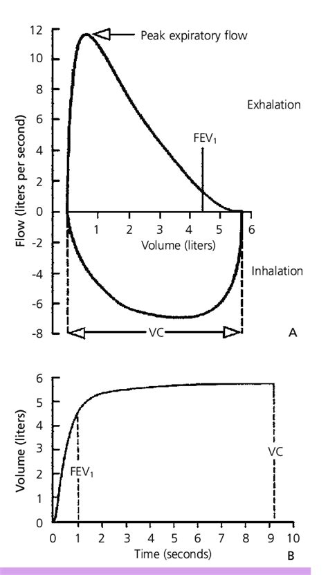 Image result for Spirometry Test Normal Values