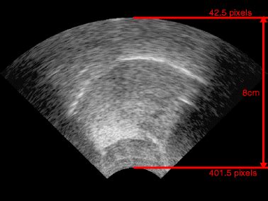 Image result for Ultrasound Scanner Depth Control