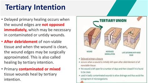 Wound Healing | PDF