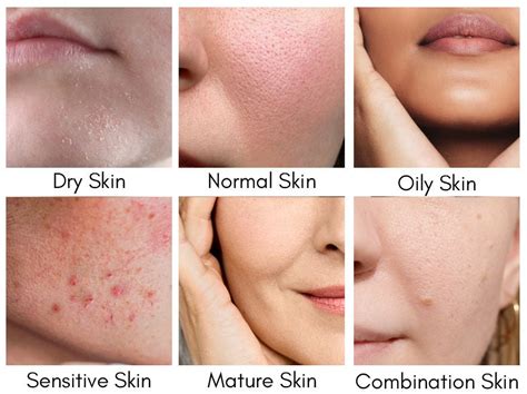 How to Recognize Your Skin Type – Be Clinical