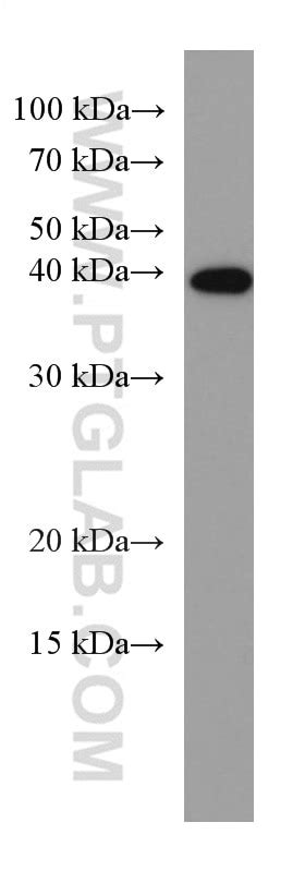 CDX2 antibody (60243-1-Ig) | Proteintech