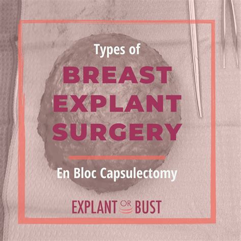 Explant or Bust! – Reliable information on breast implants, Breast Implant Illness, explant ...