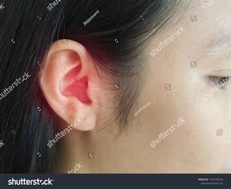 Burst Eardrum And Bleeding at Douglas Byrd blog
