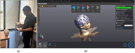 Smartphone Photogrammetric Assessment for Head Measurements