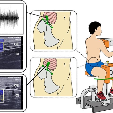 Image result for Muscle Activity EMG