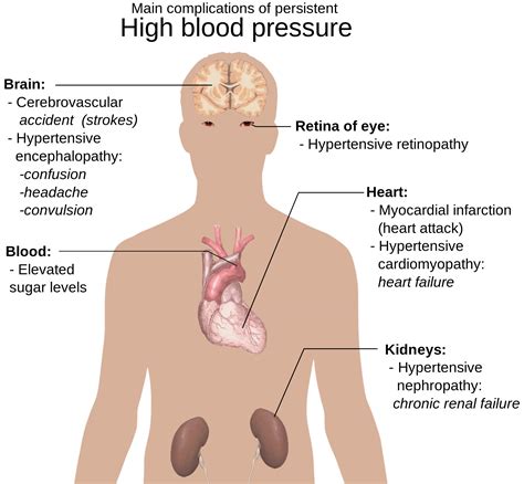 How is your blood pressure? - Waitara Family Medical Practice