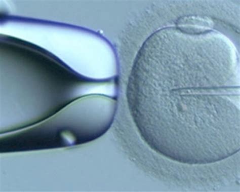 Academy of Clinical Embryologists – Promoting Clinical Embryology by ...