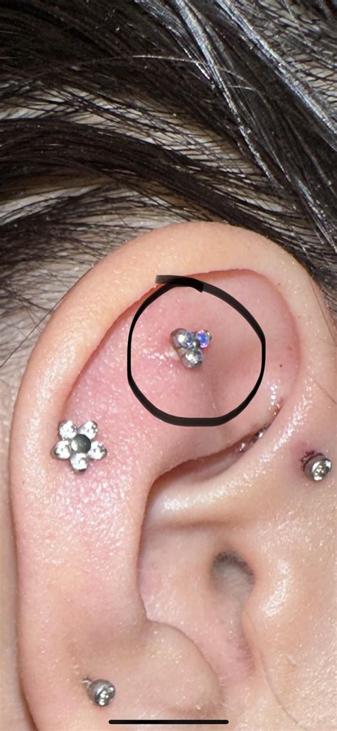piercing bump formed from getting hit. how to get rid of it? : r/piercing
