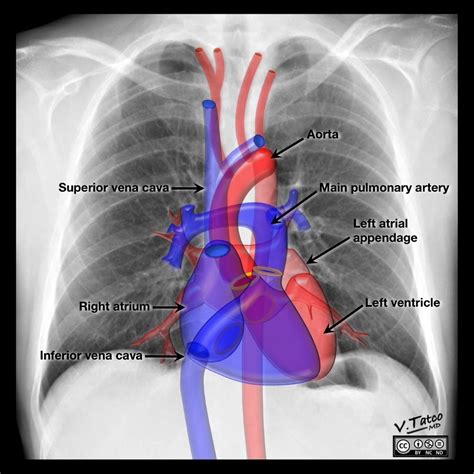 Radiology Quiz 46331 | Radiopaedia.org | Radiology, Radiography, Radiology schools