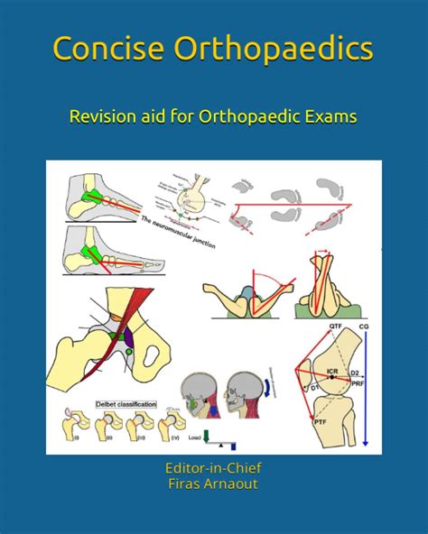 Buy Concise Orthopaedic Notes: Revision aid Book Online at Low Prices ...