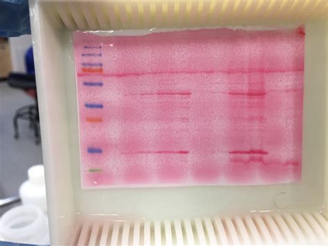 22 questions with answers in PONCEAU RED STAINING | Science topic