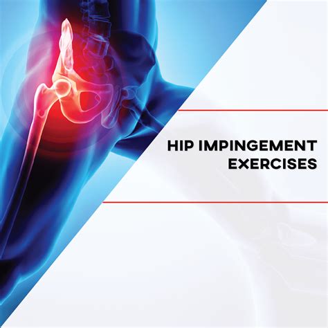 Hip Impingement Syndrome Exercises