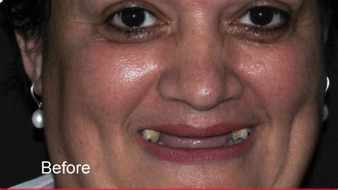 Signature Smiles Header