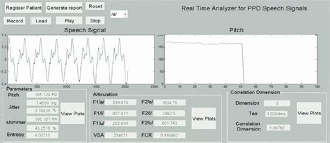 Image result for MATLAB User Interface