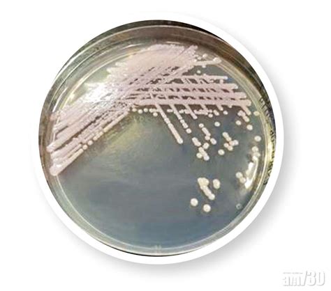 “耳念珠菌”大爆发，这些抵抗细菌冷知识，你都了解么?|冷知识|消毒|细菌_新浪新闻